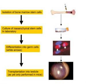 Human bone marrow