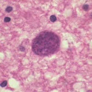 Toxoplasma gondii